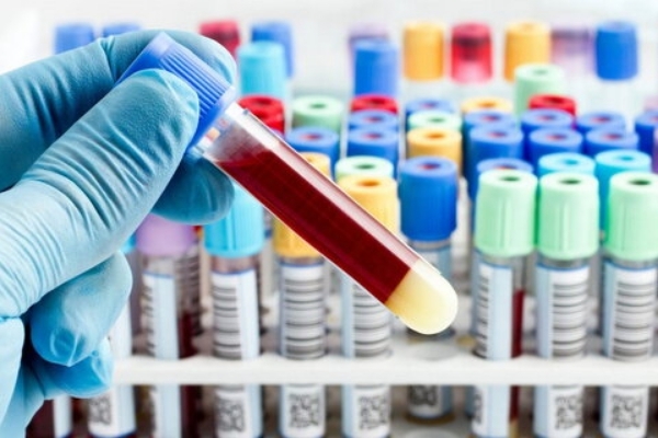 تفسیر تست‌های آزمایشگاهی