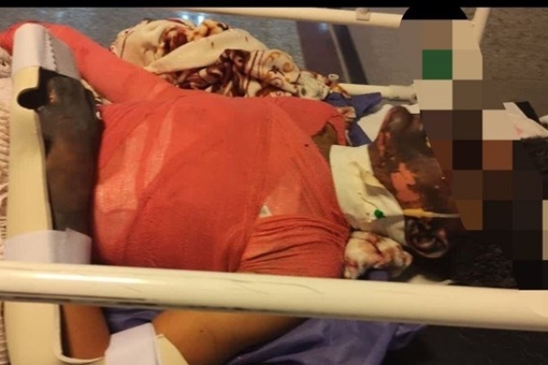 افزایش ۱۴ درصدی مصدومان چهارشنبه آخرسال/۲۷نفر فوت شدند