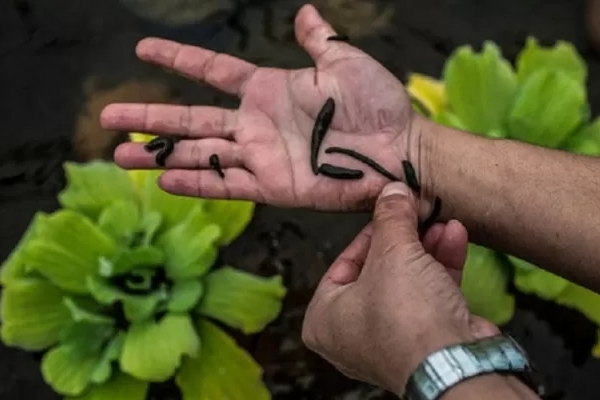 بایدها و نبایدهای زالودرمانی