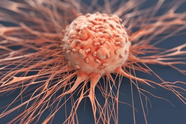 اصلاح سبک زندگی لازمه پیشگیری از سرطان