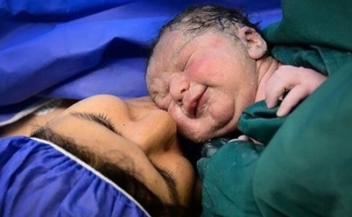 زایمان طبیعی بی‌درد، نیازمند حمایت جدی است