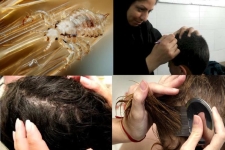 وقتی عدم رعایت بهداشت فردی بهداشت اجتماعی مدارس را به خطر می اندازد / لزوم استفاده دانش آموزان از شامپوهای پرمترین 