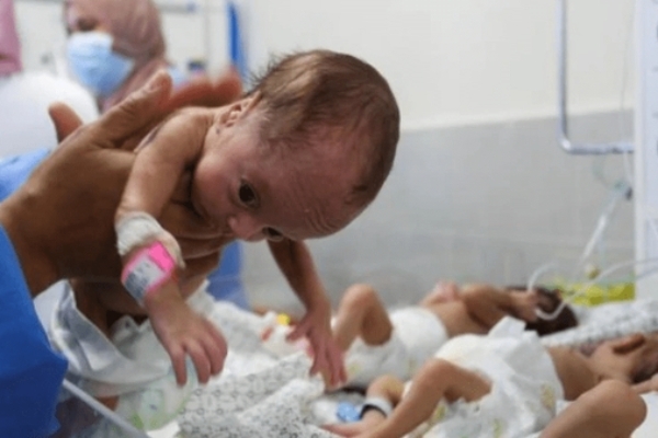 افزایش چشمگیر سقط جنین و کاهش ۴۰ درصدی تولدها در غزه