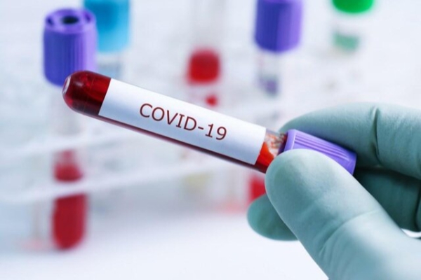کانادا انجام اولین آزمایشات بالینی واکسن "کووید-۱۹" را تایید کرد
