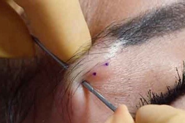 پیرسینگ؛ زیبایی که به قیمت جان تمام می‌شود!