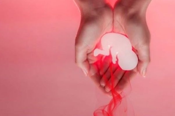 سقط جنین تبدیل به صنعت شده است