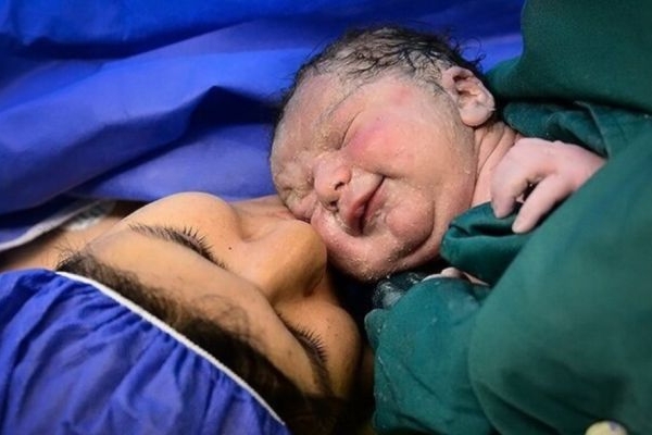 زایمان طبیعی بی‌درد، نیازمند حمایت جدی است